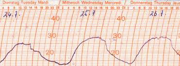 Feingerätebau K. Fischer GmbH Ersatzschreibstreifen für Thermographen